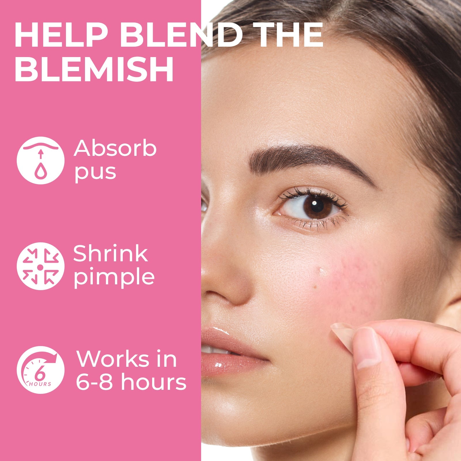 Microdart Pimple Patch – Patch Anti-Acné Invisible à Microneedles (18 pcs) - Glowbox