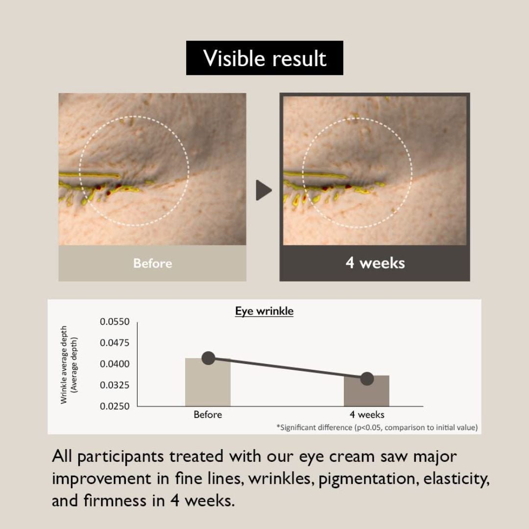 HARUHARU WONDER Black Rice Bakuchiol Eye Cream - Glowbox